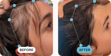 Allison’s hair before (left) and after (right) using MDhair