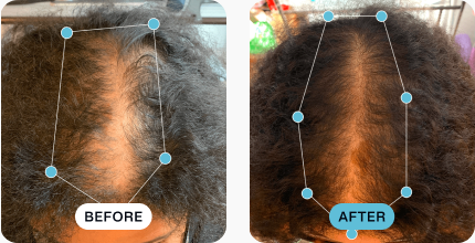 Arriana’s hair before (left) and after (right) using MDhair