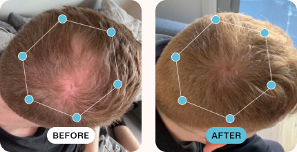 Hunter’s hair before (left) and after (right) using MDhair
