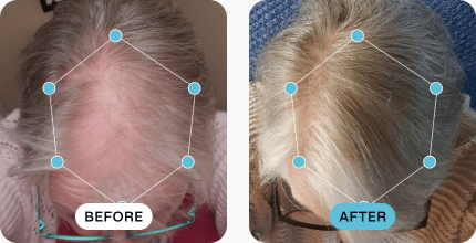 Margaret’s hair before (left) and after (right) using MDhair