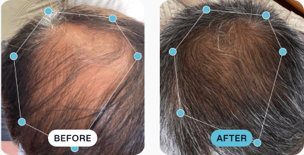 Ronnie’s hair before (left) and after (right) using MDhair